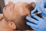 How to do PRP
